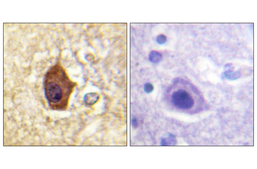 Immunohistochemistry - Anti-Synapsin1 Antibody (B1009) - Antibodies.com
