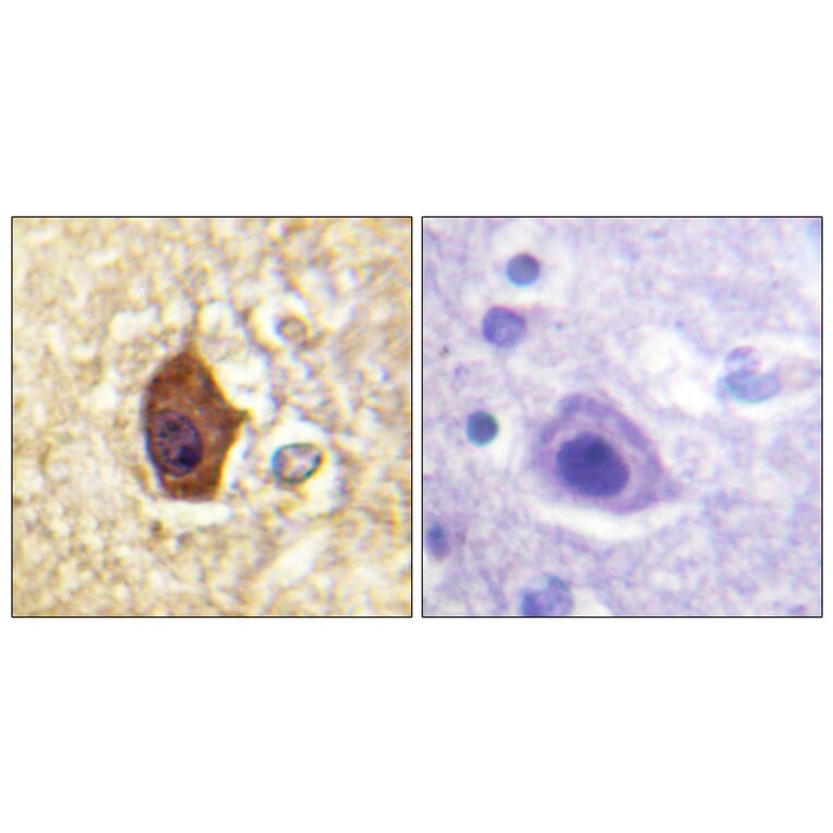 Immunohistochemistry - Anti-Synapsin1 Antibody (B1009) - Antibodies.com