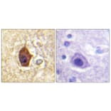 Immunohistochemistry - Anti-Synapsin1 Antibody (B1009) - Antibodies.com