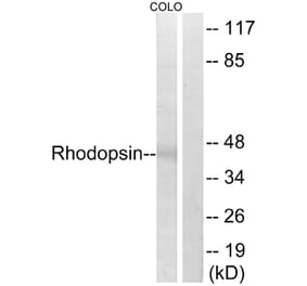 Western Blot - Anti-Rhodopsin Antibody (B0569) - Antibodies.com