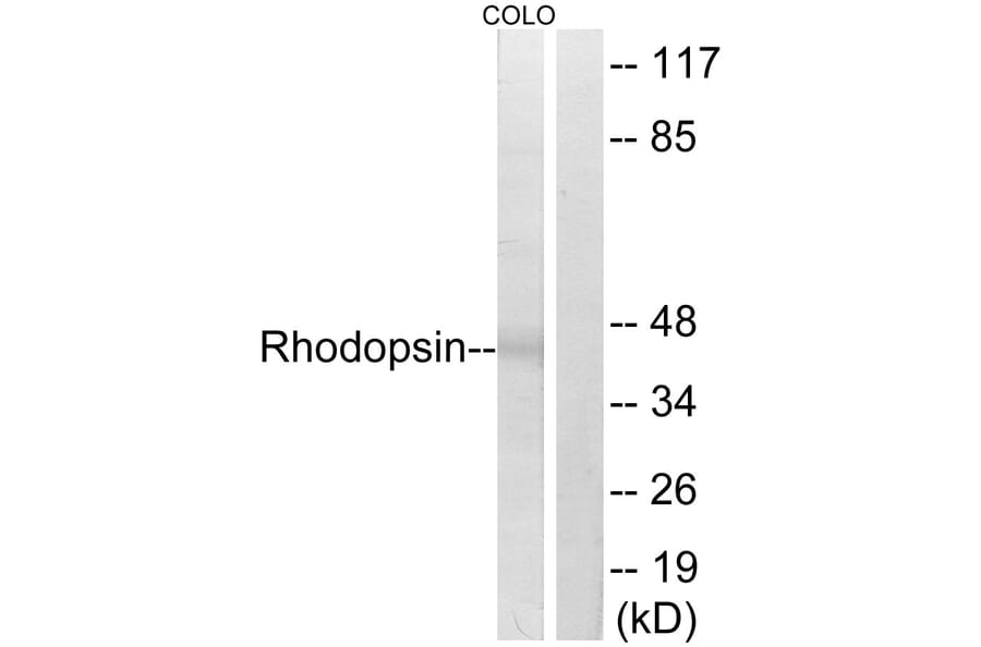 Western Blot - Anti-Rhodopsin Antibody (B0569) - Antibodies.com