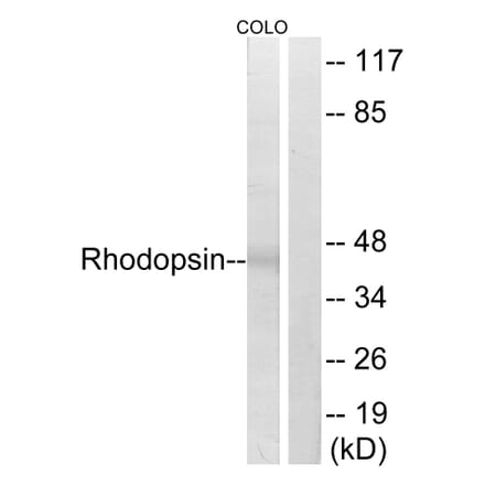 Western Blot - Anti-Rhodopsin Antibody (B0569) - Antibodies.com