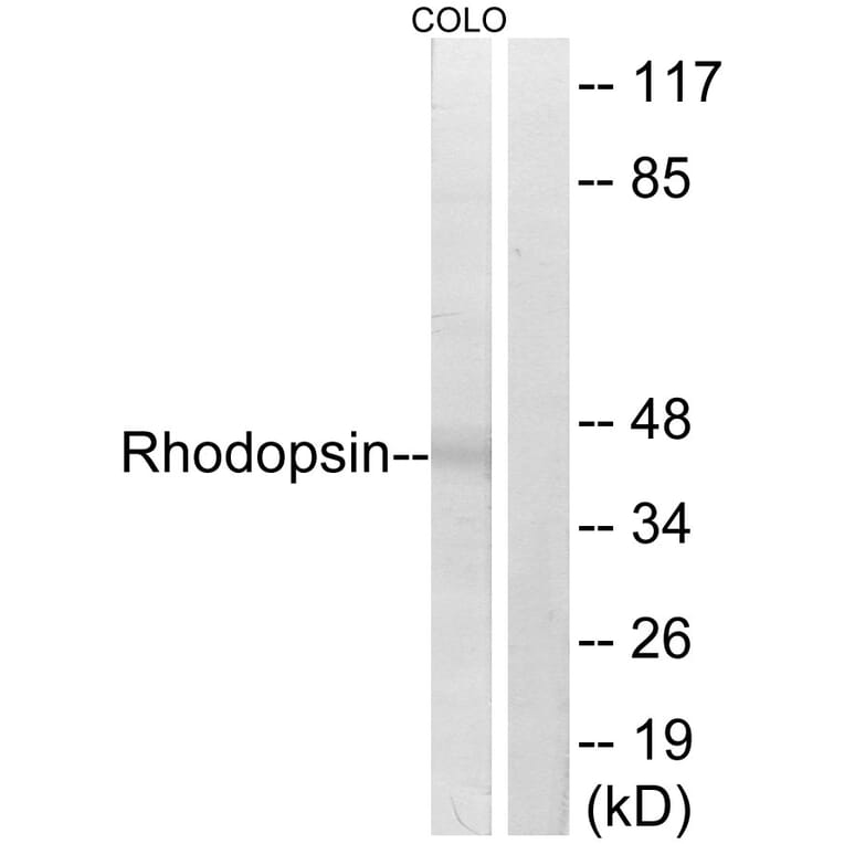 Western Blot - Anti-Rhodopsin Antibody (B0569) - Antibodies.com