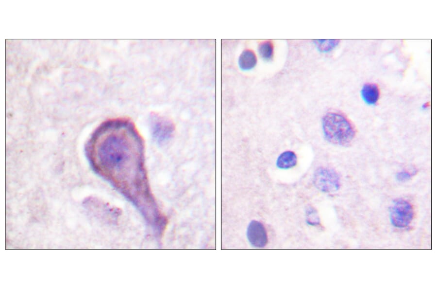 Immunohistochemistry - Anti-Rhodopsin Antibody (B0569) - Antibodies.com