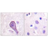 Immunohistochemistry - Anti-Rhodopsin Antibody (B0569) - Antibodies.com