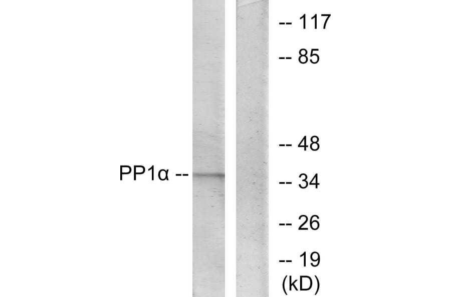 Western Blot - Anti-PP1-alpha Antibody (B0726) - Antibodies.com