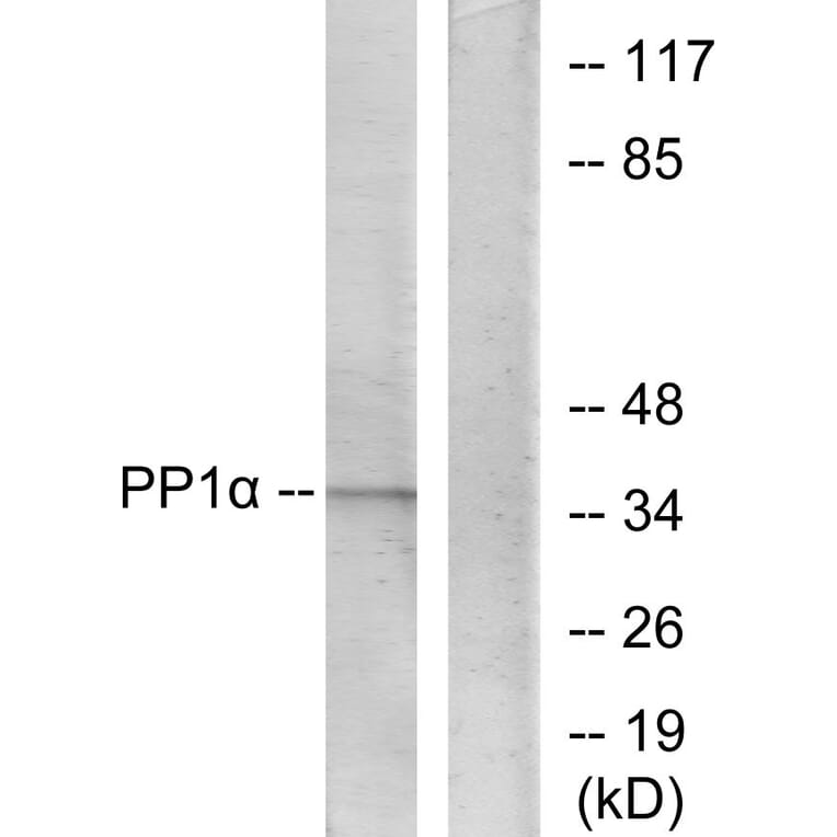Western Blot - Anti-PP1-alpha Antibody (B0726) - Antibodies.com