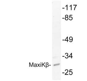 Western Blot - Anti-MaxiKbeta Antibody (R12-2234) - Antibodies.com