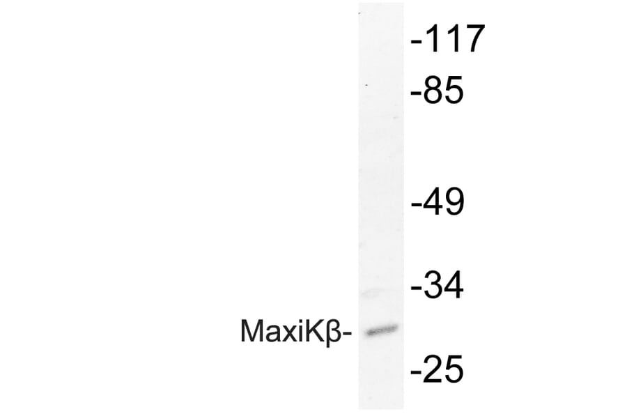 Western Blot - Anti-MaxiKbeta Antibody (R12-2234) - Antibodies.com