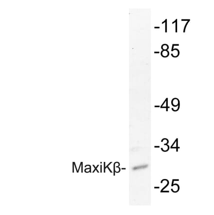 Western Blot - Anti-MaxiKbeta Antibody (R12-2234) - Antibodies.com