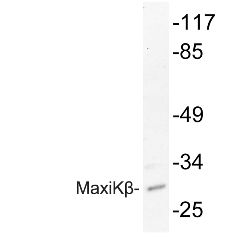 Western Blot - Anti-MaxiKbeta Antibody (R12-2234) - Antibodies.com