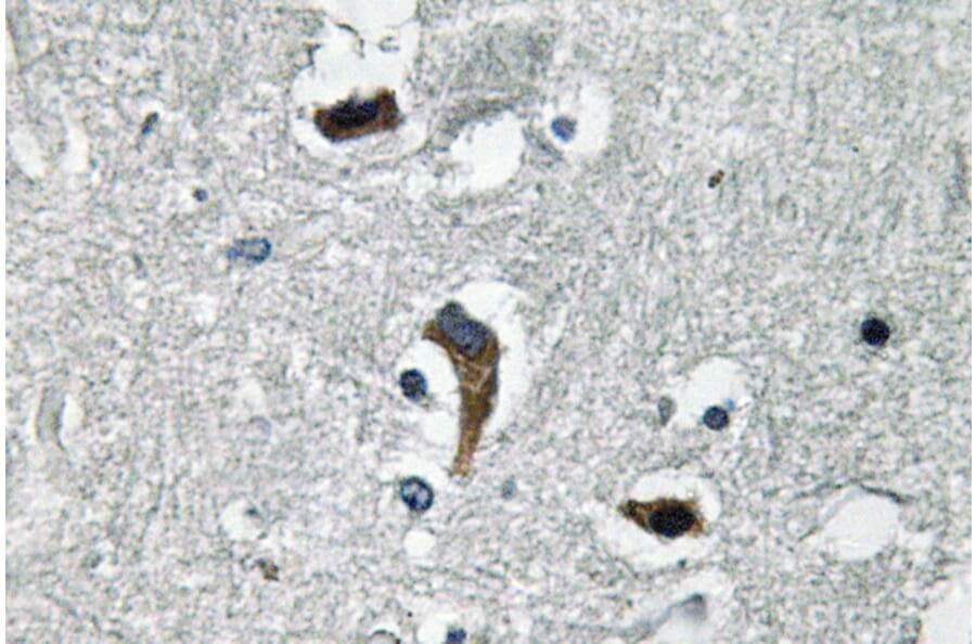 Immunohistochemistry - Anti-MaxiKbeta Antibody (R12-2234) - Antibodies.com