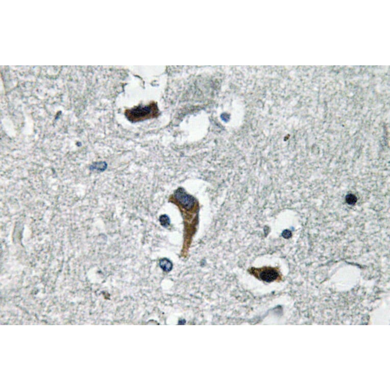 Immunohistochemistry - Anti-MaxiKbeta Antibody (R12-2234) - Antibodies.com