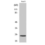 Western Blot - Anti-MaxiKbeta Antibody (R12-2234) - Antibodies.com