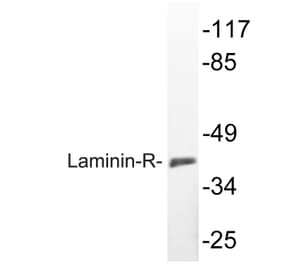 Western Blot - Anti-Laminin-R Antibody (R12-2225) - Antibodies.com