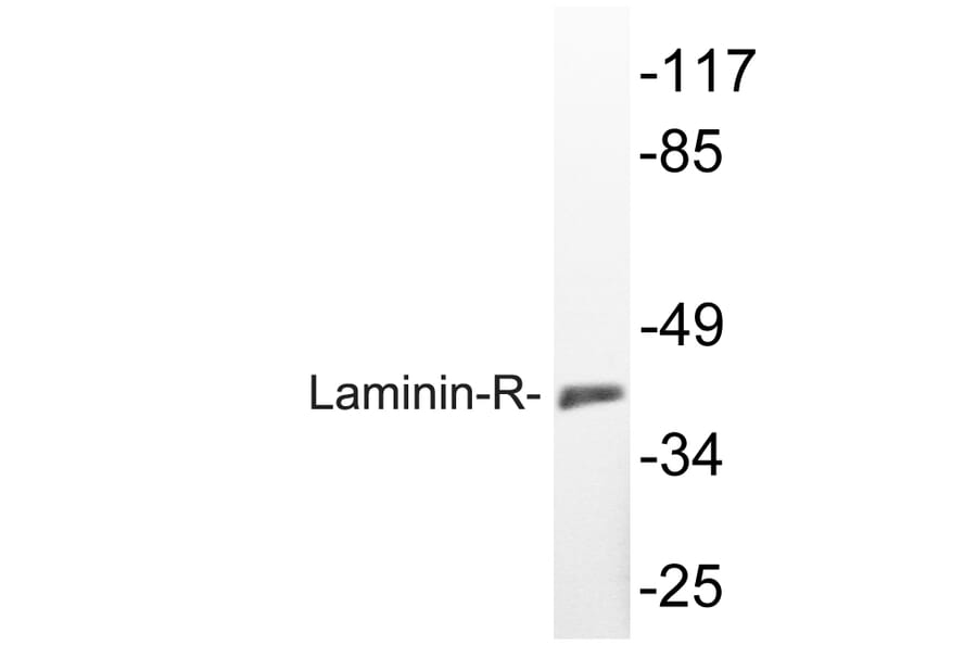 Western Blot - Anti-Laminin-R Antibody (R12-2225) - Antibodies.com