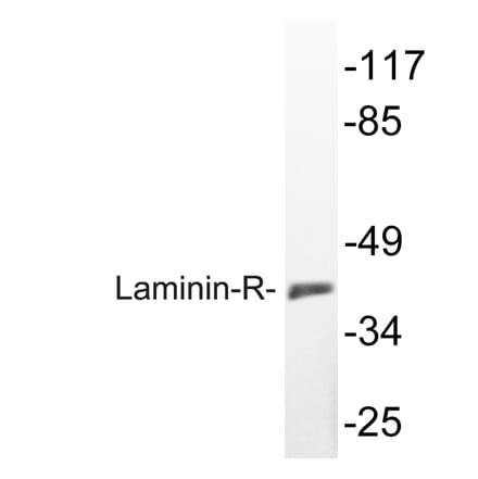 Western Blot - Anti-Laminin-R Antibody (R12-2225) - Antibodies.com