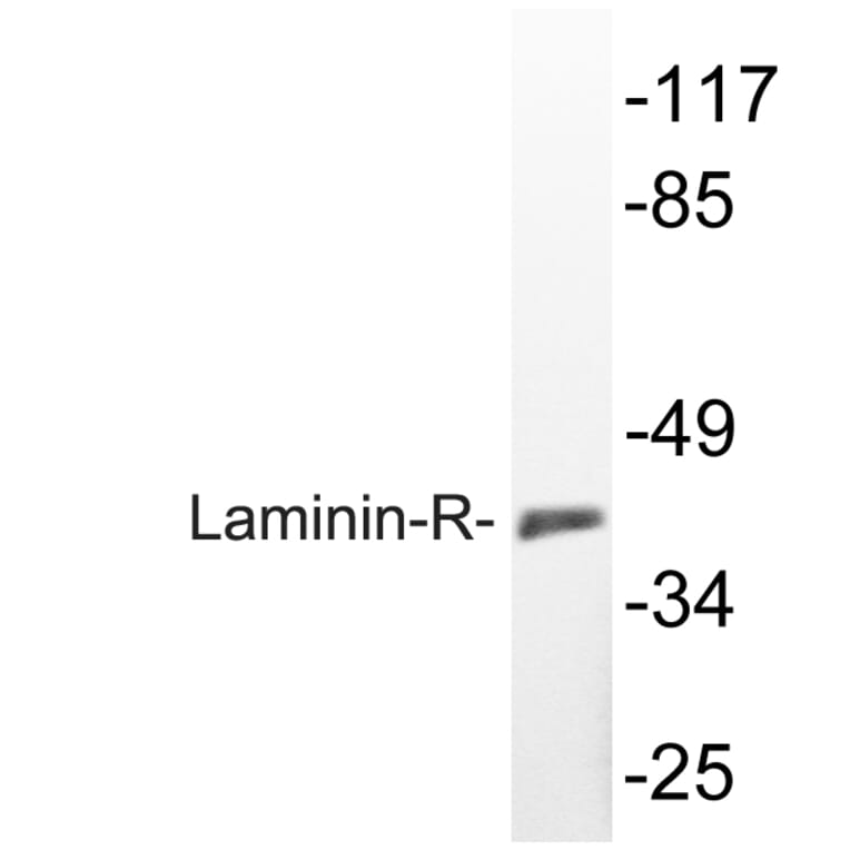 Western Blot - Anti-Laminin-R Antibody (R12-2225) - Antibodies.com