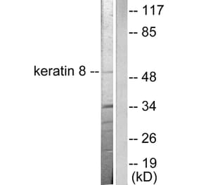 Western Blot - Anti-Keratin 8 Antibody (C0248) - Antibodies.com