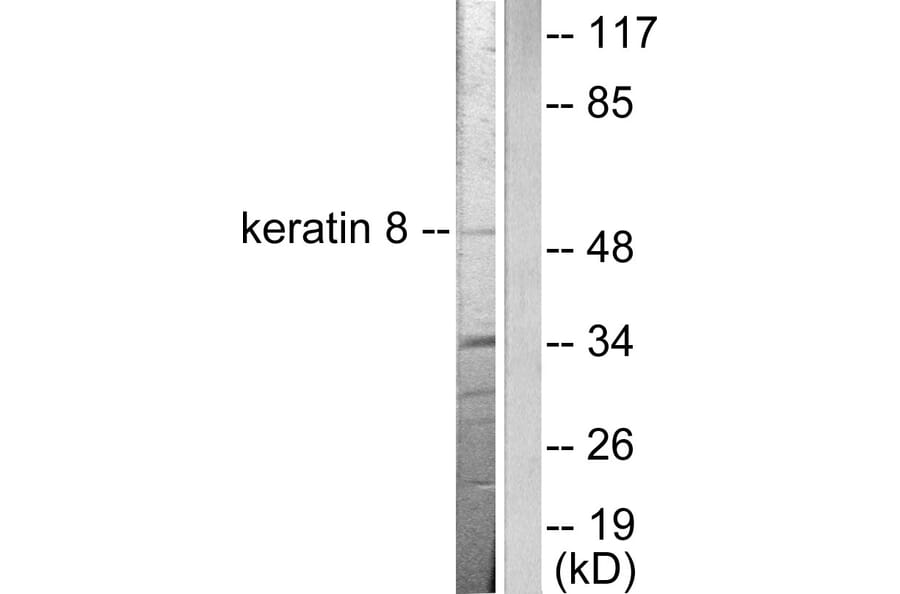 Western Blot - Anti-Keratin 8 Antibody (C0248) - Antibodies.com