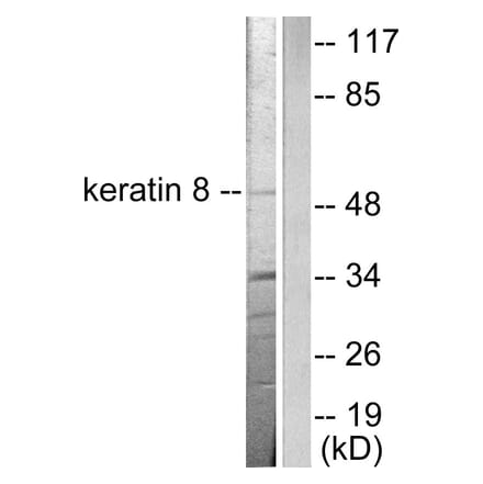 Western Blot - Anti-Keratin 8 Antibody (C0248) - Antibodies.com