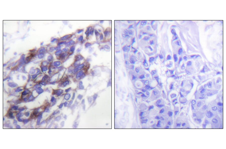 Immunohistochemistry - Anti-Keratin 8 Antibody (C0248) - Antibodies.com