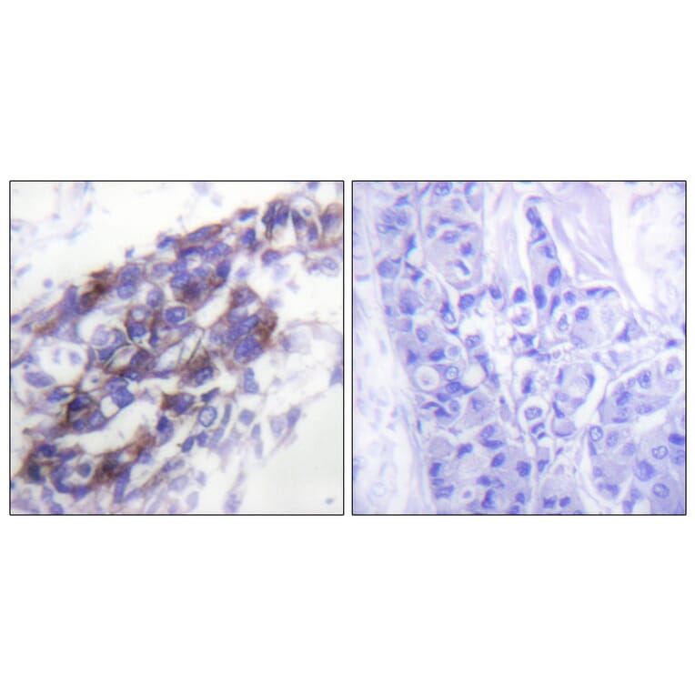 Immunohistochemistry - Anti-Keratin 8 Antibody (C0248) - Antibodies.com