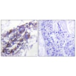 Immunohistochemistry - Anti-Keratin 8 Antibody (C0248) - Antibodies.com