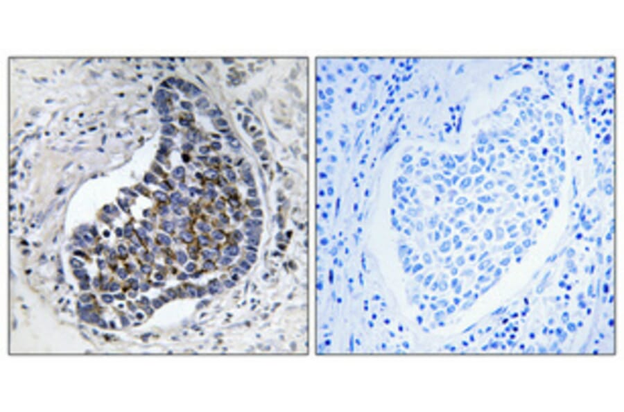 Immunohistochemistry - Anti-Keratin 8 Antibody (C0248) - Antibodies.com