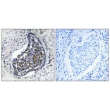 Immunohistochemistry - Anti-Keratin 8 Antibody (C0248) - Antibodies.com