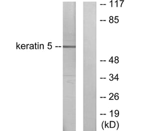 Western Blot - Anti-Keratin 5 Antibody (C0246) - Antibodies.com