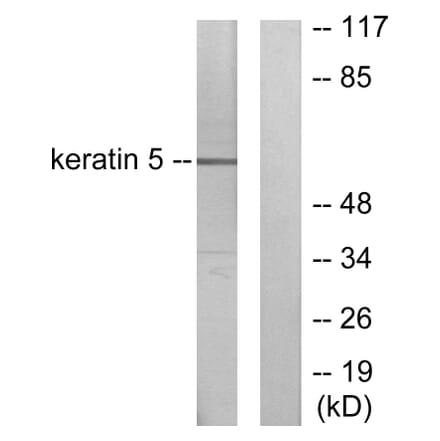 Western Blot - Anti-Keratin 5 Antibody (C0246) - Antibodies.com