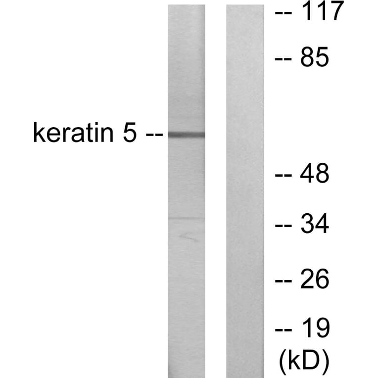 Western Blot - Anti-Keratin 5 Antibody (C0246) - Antibodies.com