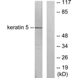 Western Blot - Anti-Keratin 5 Antibody (C0246) - Antibodies.com