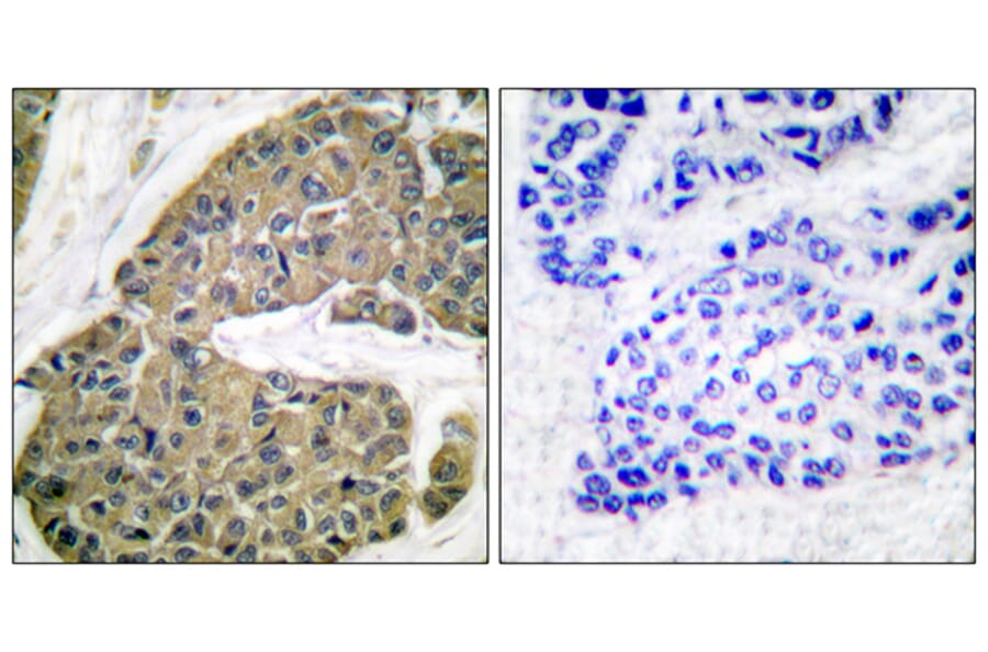 Immunohistochemistry - Anti-Keratin 5 Antibody (C0246) - Antibodies.com