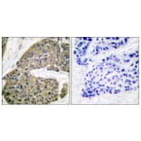 Immunohistochemistry - Anti-Keratin 5 Antibody (C0246) - Antibodies.com