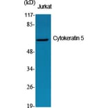Western Blot - Anti-Keratin 5 Antibody (C0246) - Antibodies.com