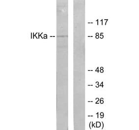 Western Blot - Anti-IKK-alpha Antibody (B7117) - Antibodies.com