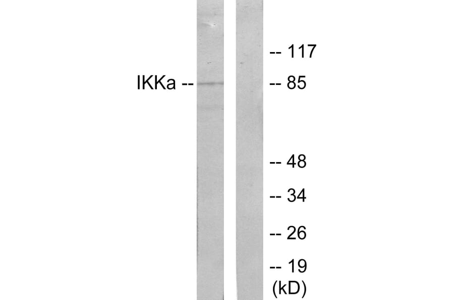 Western Blot - Anti-IKK-alpha Antibody (B7117) - Antibodies.com