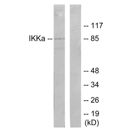 Western Blot - Anti-IKK-alpha Antibody (B7117) - Antibodies.com