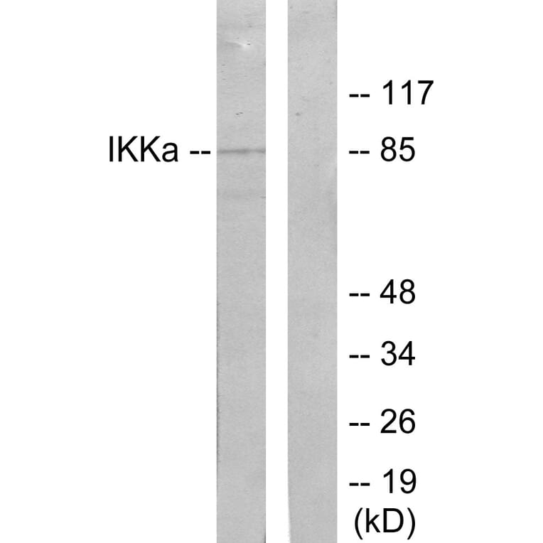Western Blot - Anti-IKK-alpha Antibody (B7117) - Antibodies.com