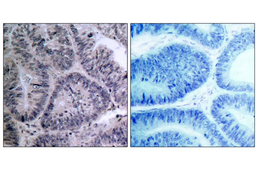 Immunohistochemistry - Anti-IKK-alpha Antibody (B7117) - Antibodies.com