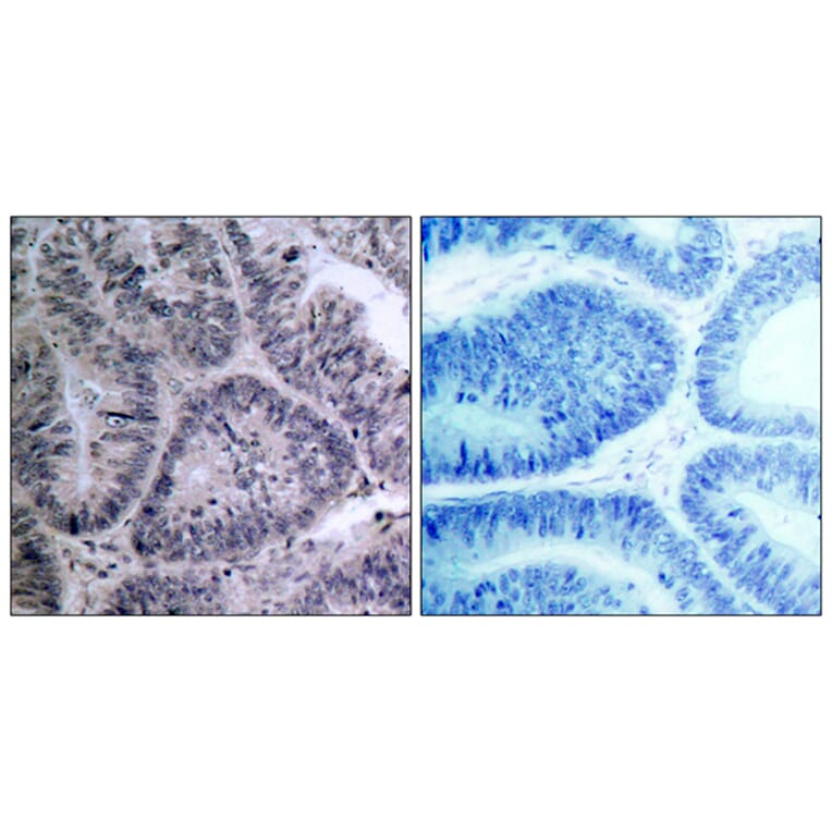 Immunohistochemistry - Anti-IKK-alpha Antibody (B7117) - Antibodies.com
