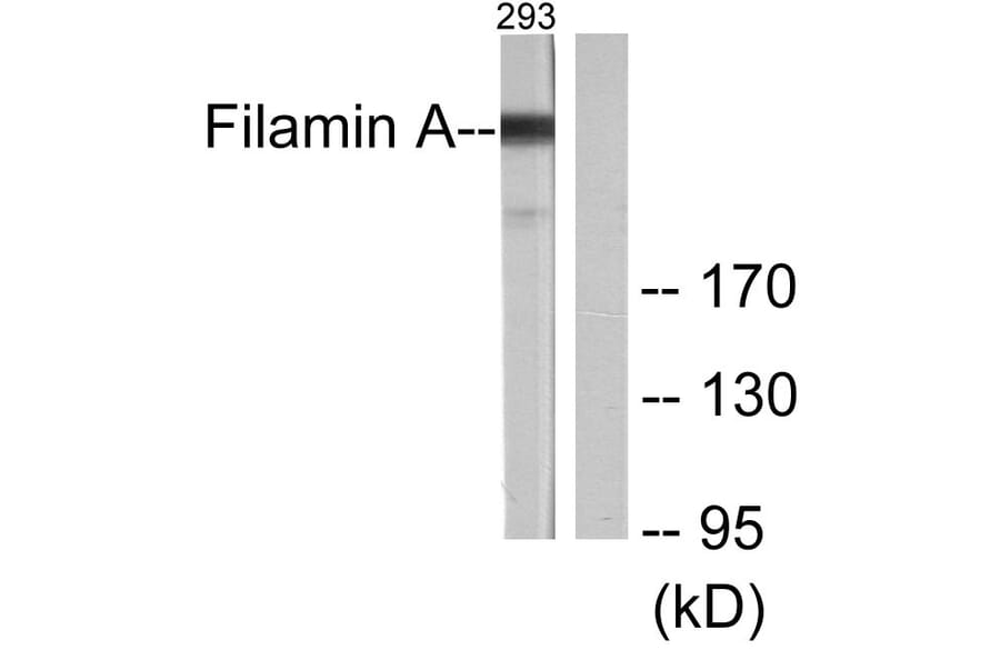 Western Blot - Anti-Filamin A Antibody (B0072) - Antibodies.com
