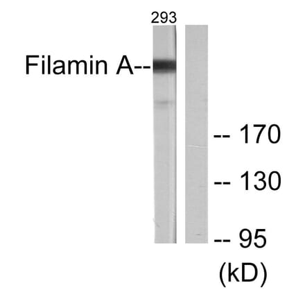 Western Blot - Anti-Filamin A Antibody (B0072) - Antibodies.com