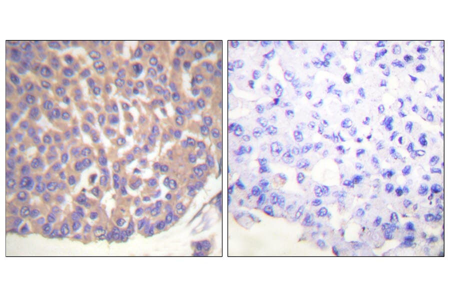 Immunohistochemistry - Anti-Filamin A Antibody (B0072) - Antibodies.com