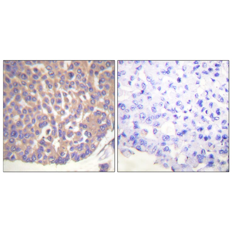 Immunohistochemistry - Anti-Filamin A Antibody (B0072) - Antibodies.com