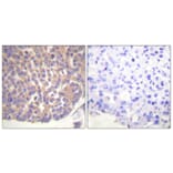 Immunohistochemistry - Anti-Filamin A Antibody (B0072) - Antibodies.com