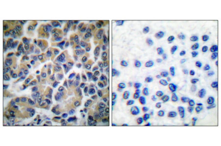 Immunohistochemistry - Anti-Filamin A Antibody (B0072) - Antibodies.com