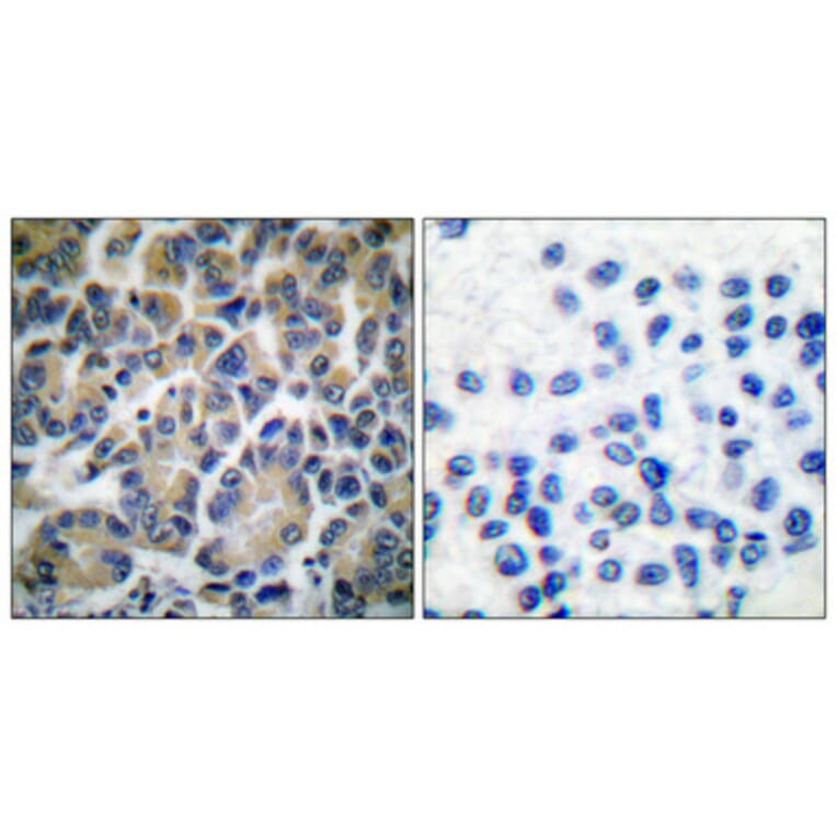 Immunohistochemistry - Anti-Filamin A Antibody (B0072) - Antibodies.com